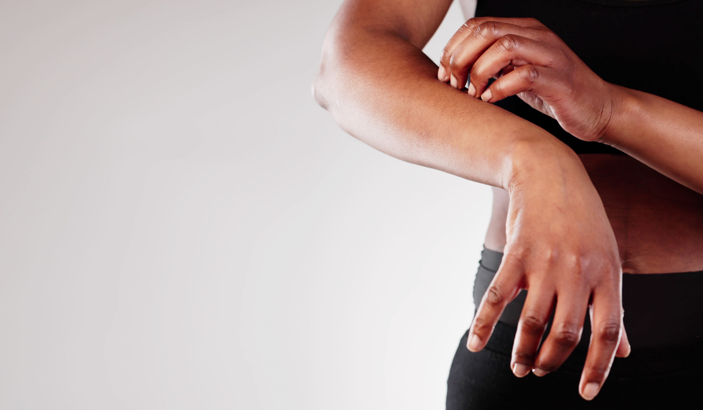A Daily Pill for Chronic Hives Just Got a Major Expansion